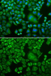 Anti-Arp3 antibody used in Immunocytochemistry/ Immunofluorescence (ICC/IF). GTX30023