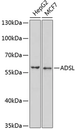 Anti-ADSL antibody used in Western Blot (WB). GTX30029