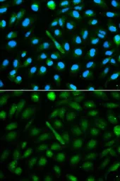 Anti-Fetuin A antibody used in Immunocytochemistry/ Immunofluorescence (ICC/IF). GTX30034