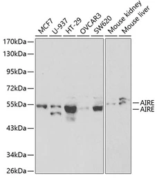 Anti-AIRE antibody used in Western Blot (WB). GTX30036