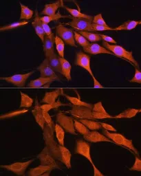 Anti-AIRE antibody used in Immunocytochemistry/ Immunofluorescence (ICC/IF). GTX30036