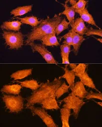 Anti-AIRE antibody used in Immunocytochemistry/ Immunofluorescence (ICC/IF). GTX30036