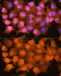 Anti-AIRE antibody used in Immunocytochemistry/ Immunofluorescence (ICC/IF). GTX30036