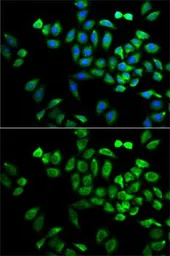 Anti-Angiopoietin-like 4 antibody used in Immunocytochemistry/ Immunofluorescence (ICC/IF). GTX30047