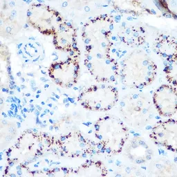Anti-Angiopoietin-like 4 antibody used in IHC (Paraffin sections) (IHC-P). GTX30047