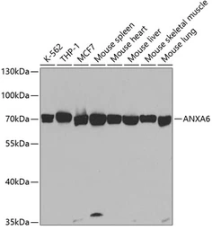 Anti-Annexin VI antibody used in Western Blot (WB). GTX30050