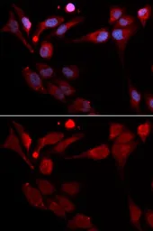 Anti-FE65 antibody used in Immunocytochemistry/ Immunofluorescence (ICC/IF). GTX30053