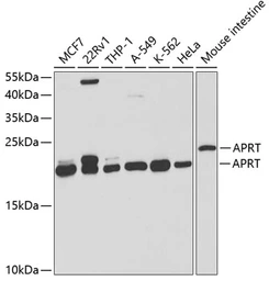 Anti-APRT antibody used in Western Blot (WB). GTX30061