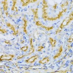 Anti-ARF6 antibody used in IHC (Paraffin sections) (IHC-P). GTX30062