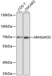Anti-ARHGAP25 antibody used in Western Blot (WB). GTX30063