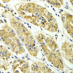 Anti-ARHGAP25 antibody used in IHC (Paraffin sections) (IHC-P). GTX30063