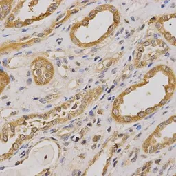 Anti-ARHGAP25 antibody used in IHC (Paraffin sections) (IHC-P). GTX30063