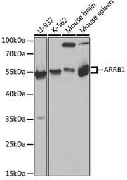 Anti-beta Arrestin 1 antibody used in Western Blot (WB). GTX30065