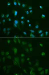 Anti-beta Arrestin 1 antibody used in Immunocytochemistry/ Immunofluorescence (ICC/IF). GTX30065