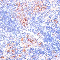Anti-beta Arrestin 1 antibody used in IHC (Paraffin sections) (IHC-P). GTX30065