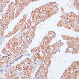 Anti-beta Arrestin 1 antibody used in IHC (Paraffin sections) (IHC-P). GTX30065