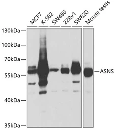 Anti-Asparagine synthetase antibody used in Western Blot (WB). GTX30068