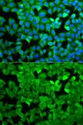 Anti-Asparagine synthetase antibody used in Immunocytochemistry/ Immunofluorescence (ICC/IF). GTX30068