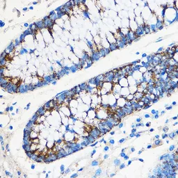 Anti-ATF6 antibody used in IHC (Paraffin sections) (IHC-P). GTX30071