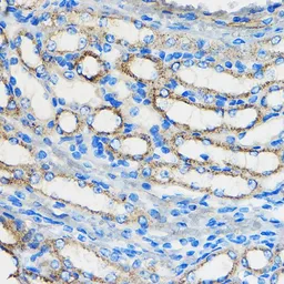 Anti-ATF6 antibody used in IHC (Paraffin sections) (IHC-P). GTX30071