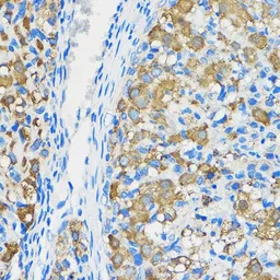Anti-ATF6 antibody used in IHC (Paraffin sections) (IHC-P). GTX30071