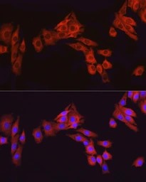 Anti-ATF6 antibody used in Immunocytochemistry/ Immunofluorescence (ICC/IF). GTX30071