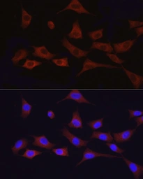 Anti-ATF6 antibody used in Immunocytochemistry/ Immunofluorescence (ICC/IF). GTX30071