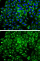 Anti-ATG16L1 antibody used in Immunocytochemistry/ Immunofluorescence (ICC/IF). GTX30072