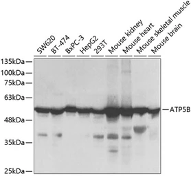 Anti-ATP5B antibody used in Western Blot (WB). GTX30075