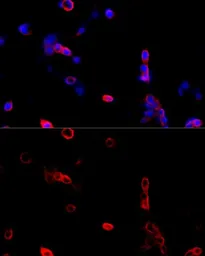 Anti-ATP5B antibody used in Immunocytochemistry/ Immunofluorescence (ICC/IF). GTX30075