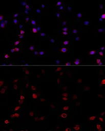 Anti-ATP5B antibody used in Immunocytochemistry/ Immunofluorescence (ICC/IF). GTX30075