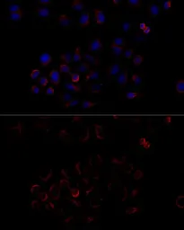 Anti-ATP5B antibody used in Immunocytochemistry/ Immunofluorescence (ICC/IF). GTX30075