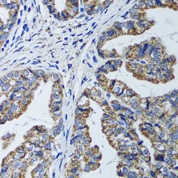 Anti-ATP5B antibody used in IHC (Paraffin sections) (IHC-P). GTX30075