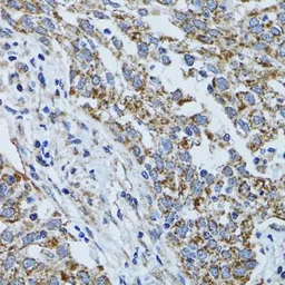 Anti-ATP5B antibody used in IHC (Paraffin sections) (IHC-P). GTX30075