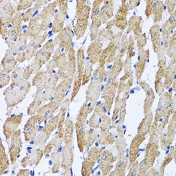 Anti-ATP5B antibody used in IHC (Paraffin sections) (IHC-P). GTX30075