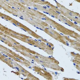 Anti-ATP5B antibody used in IHC (Paraffin sections) (IHC-P). GTX30075