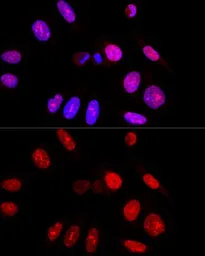 Anti-Ataxin 3 antibody used in Immunocytochemistry/ Immunofluorescence (ICC/IF). GTX30079