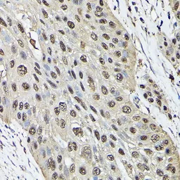 Anti-Ataxin 3 antibody used in IHC (Paraffin sections) (IHC-P). GTX30079