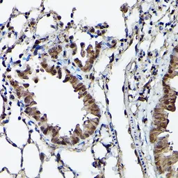 Anti-Ataxin 3 antibody used in IHC (Paraffin sections) (IHC-P). GTX30079