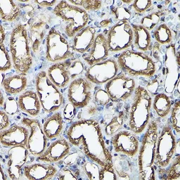 Anti-Ataxin 3 antibody used in IHC (Paraffin sections) (IHC-P). GTX30079