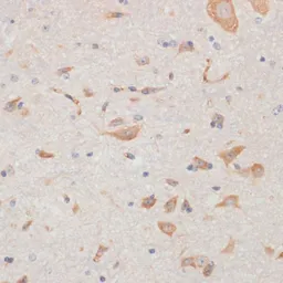 Anti-Axin 2 antibody used in IHC (Paraffin sections) (IHC-P). GTX30080