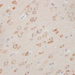 Anti-Axin 2 antibody used in IHC (Paraffin sections) (IHC-P). GTX30080