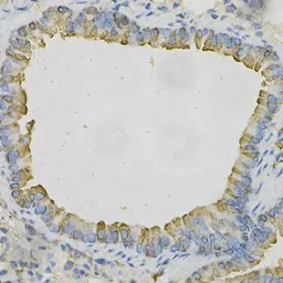 Anti-AZGP1 antibody used in IHC (Paraffin sections) (IHC-P). GTX30081
