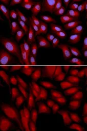 Anti-Bag1 antibody used in Immunocytochemistry/ Immunofluorescence (ICC/IF). GTX30082