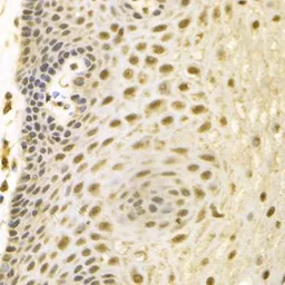 Anti-Bag1 antibody used in IHC (Paraffin sections) (IHC-P). GTX30082
