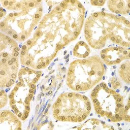 Anti-Bag1 antibody used in IHC (Paraffin sections) (IHC-P). GTX30082
