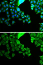 Anti-Bcl-G antibody used in Immunocytochemistry/ Immunofluorescence (ICC/IF). GTX30086