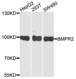 Anti-BMPR2 antibody used in Western Blot (WB). GTX30090