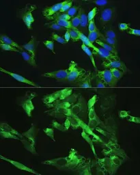 Anti-BMPR2 antibody used in Immunocytochemistry/ Immunofluorescence (ICC/IF). GTX30090