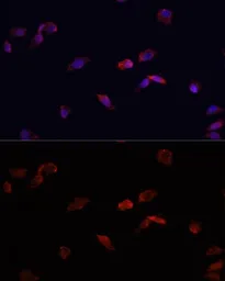 Anti-BMPR2 antibody used in Immunocytochemistry/ Immunofluorescence (ICC/IF). GTX30090
